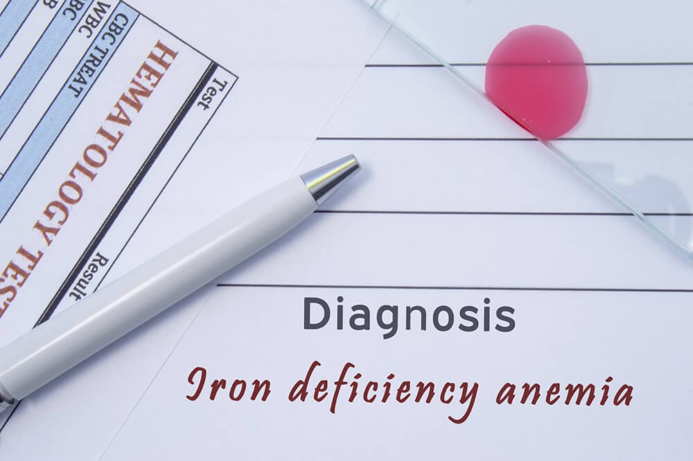 Iron Deficiency Anemia Symptoms, Causes & Treatment
