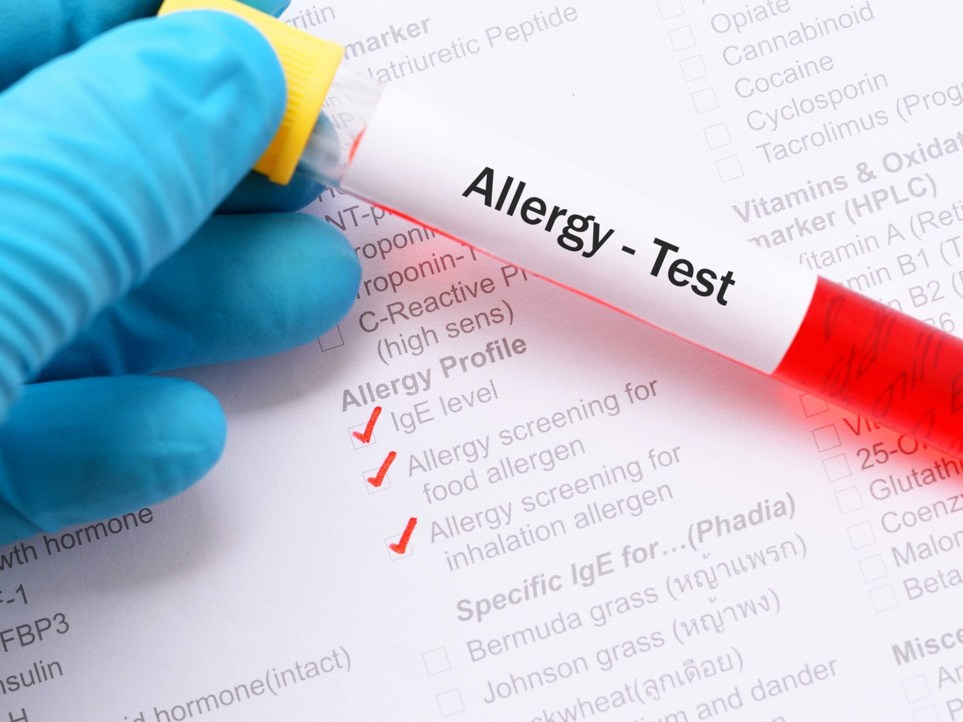 Allergy Tests In Gurgaon
