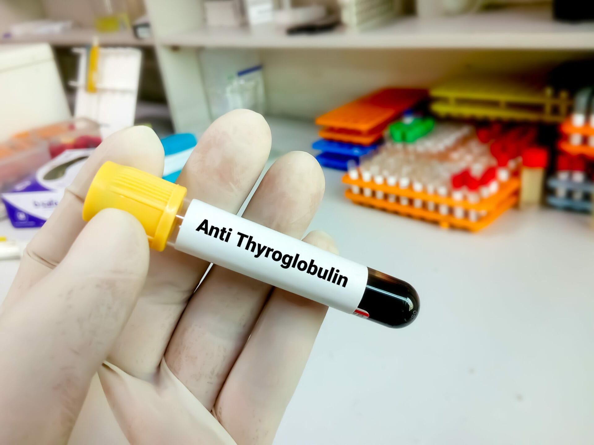 Thyroglobulin (Tg) Test in Pune