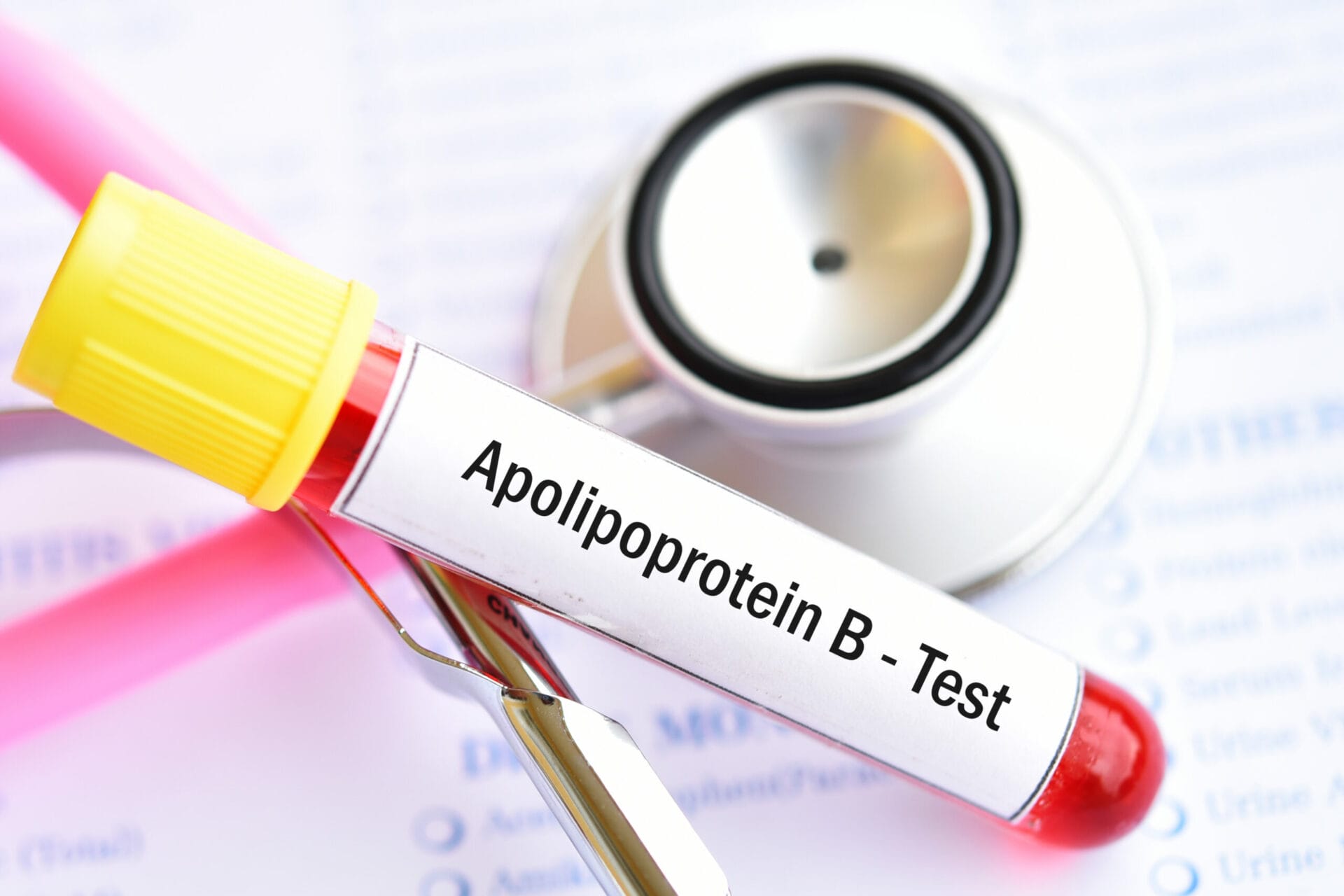 Apolipoprotein B Test in Noida