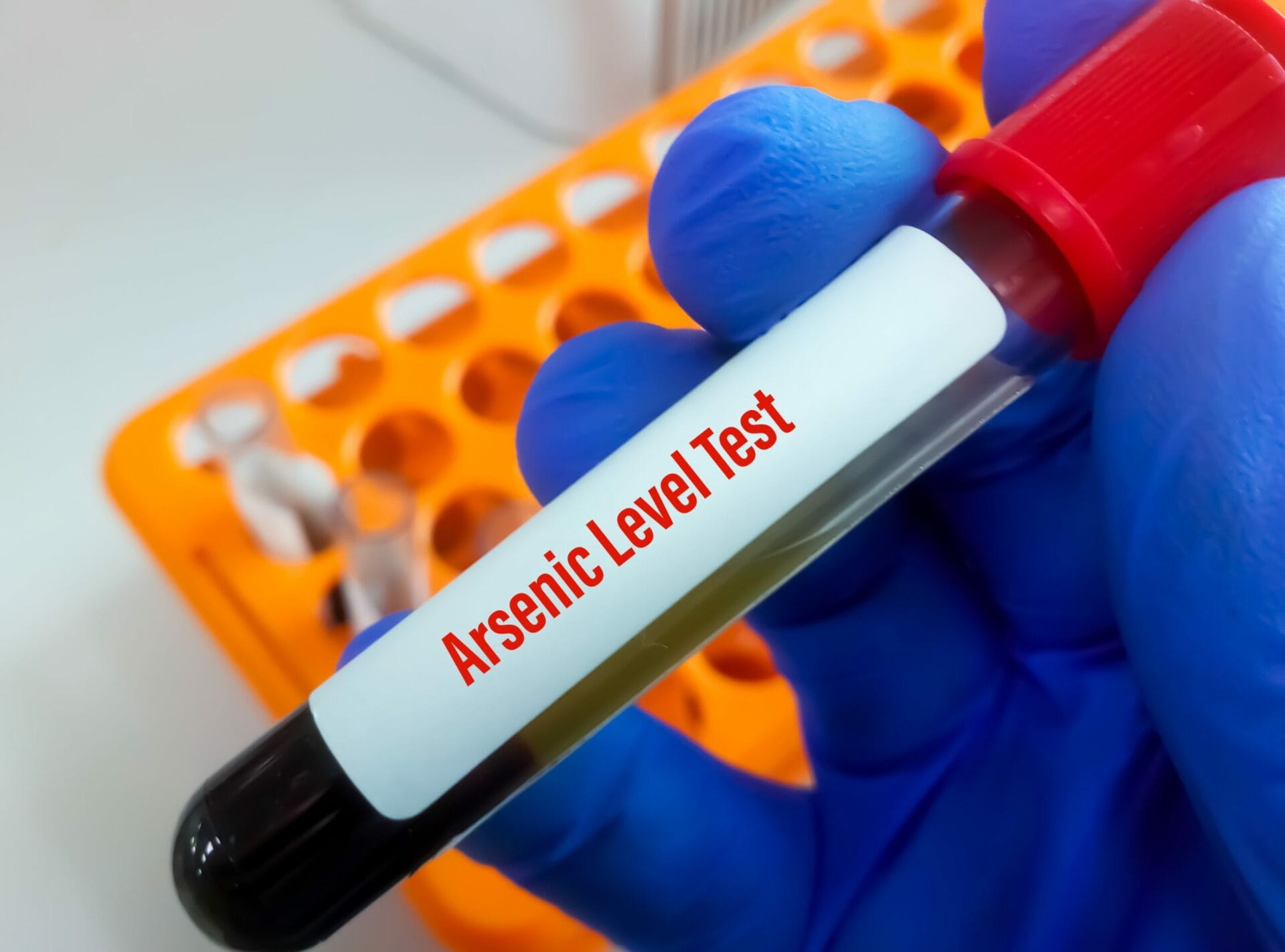 Arsenic - Blood Test In Delhi
