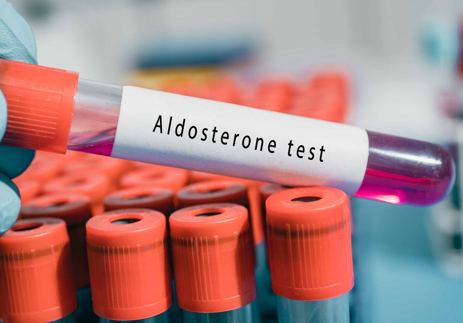 Aldosterone Serum Test In Lucknow