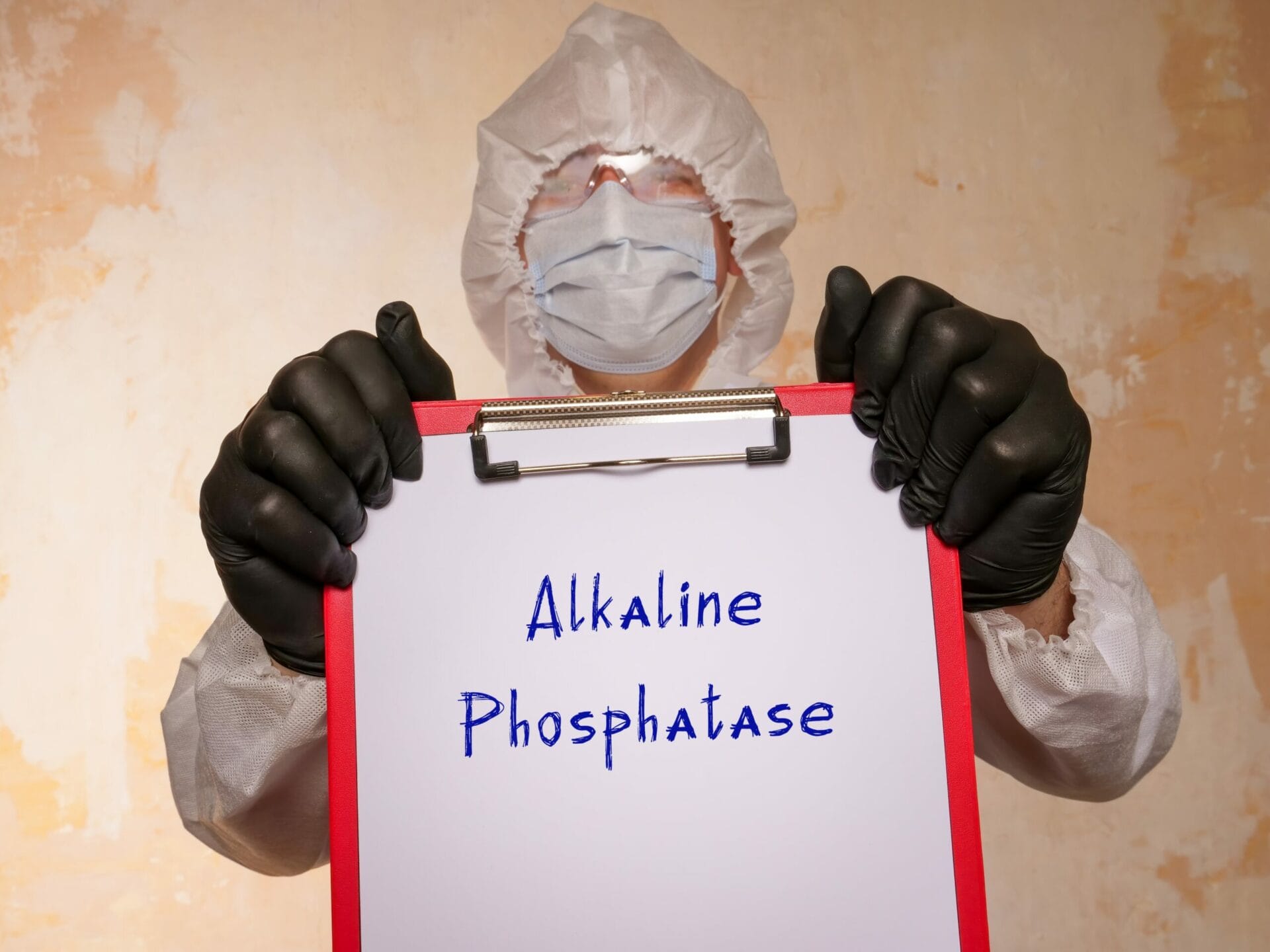 Alkaline Phosphatase Test in Lucknow