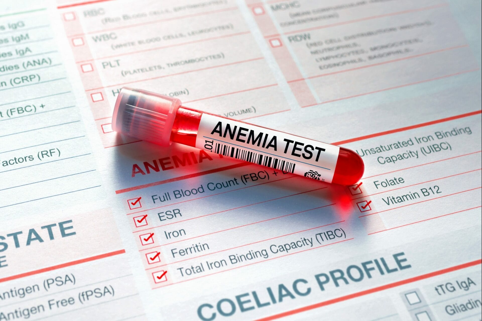 Anemia Profile Test In Noida