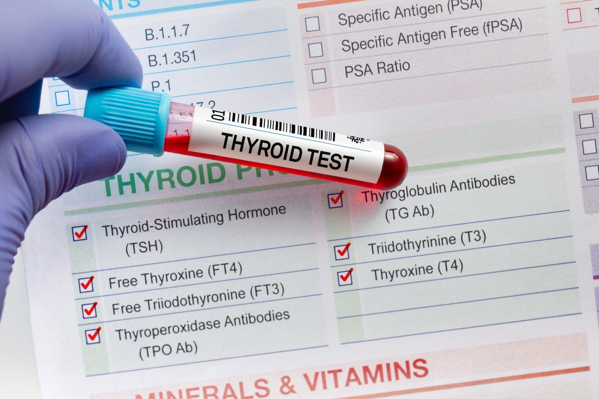 Thyroid Tests In Hyderabad
