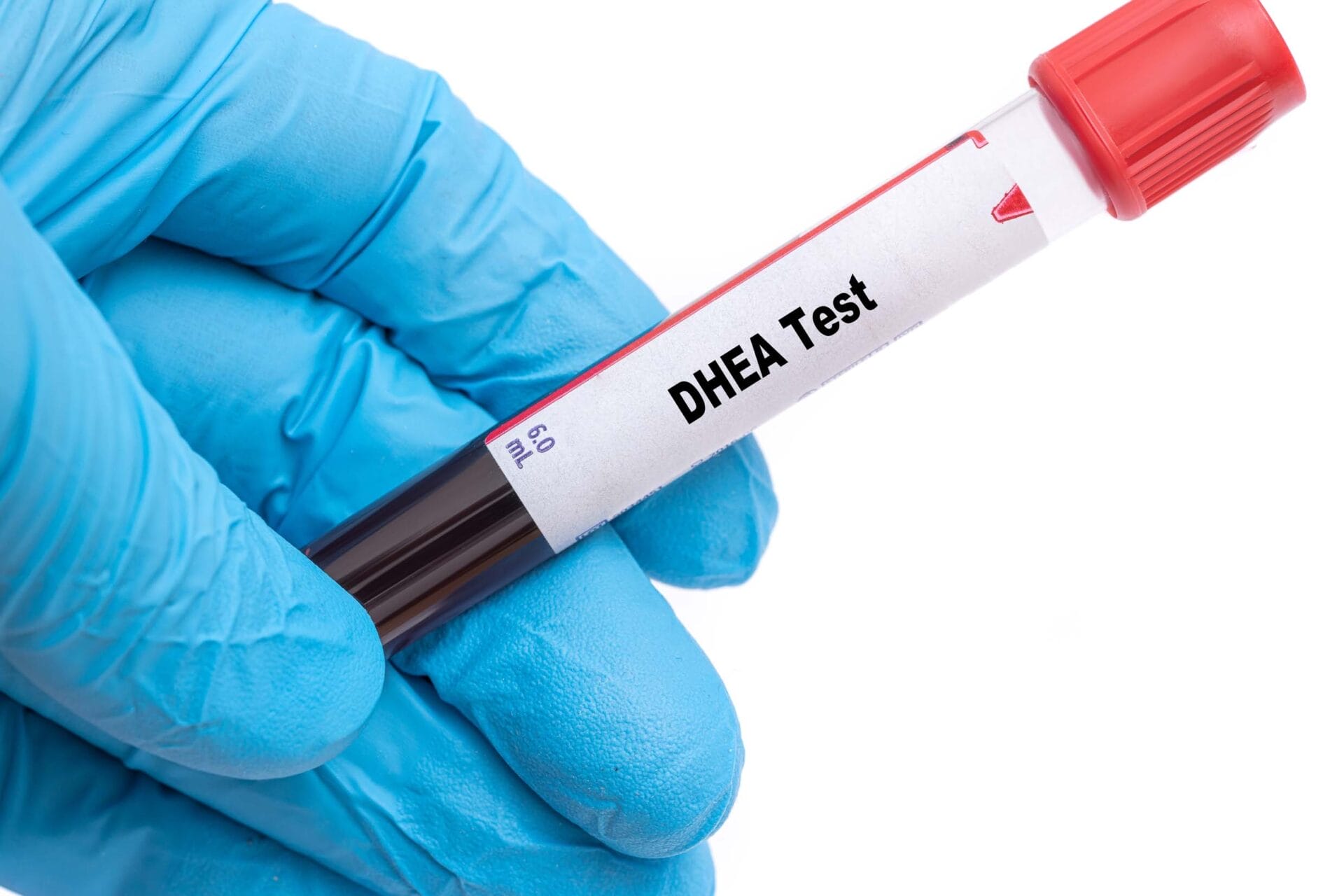 Book DHEA Test in Pune