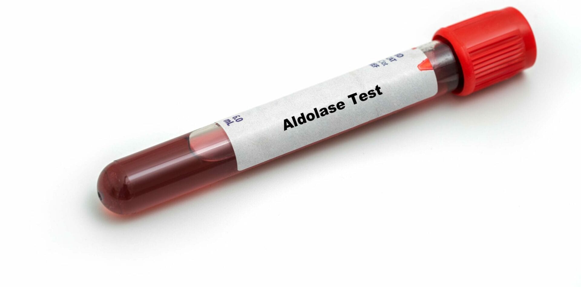 Aldolase Test In Lucknow