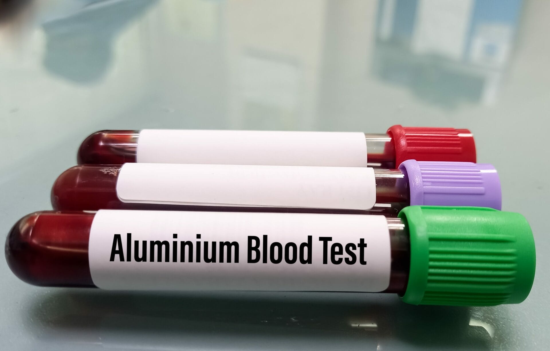 Book Aluminium Serum Test in Gurgaon