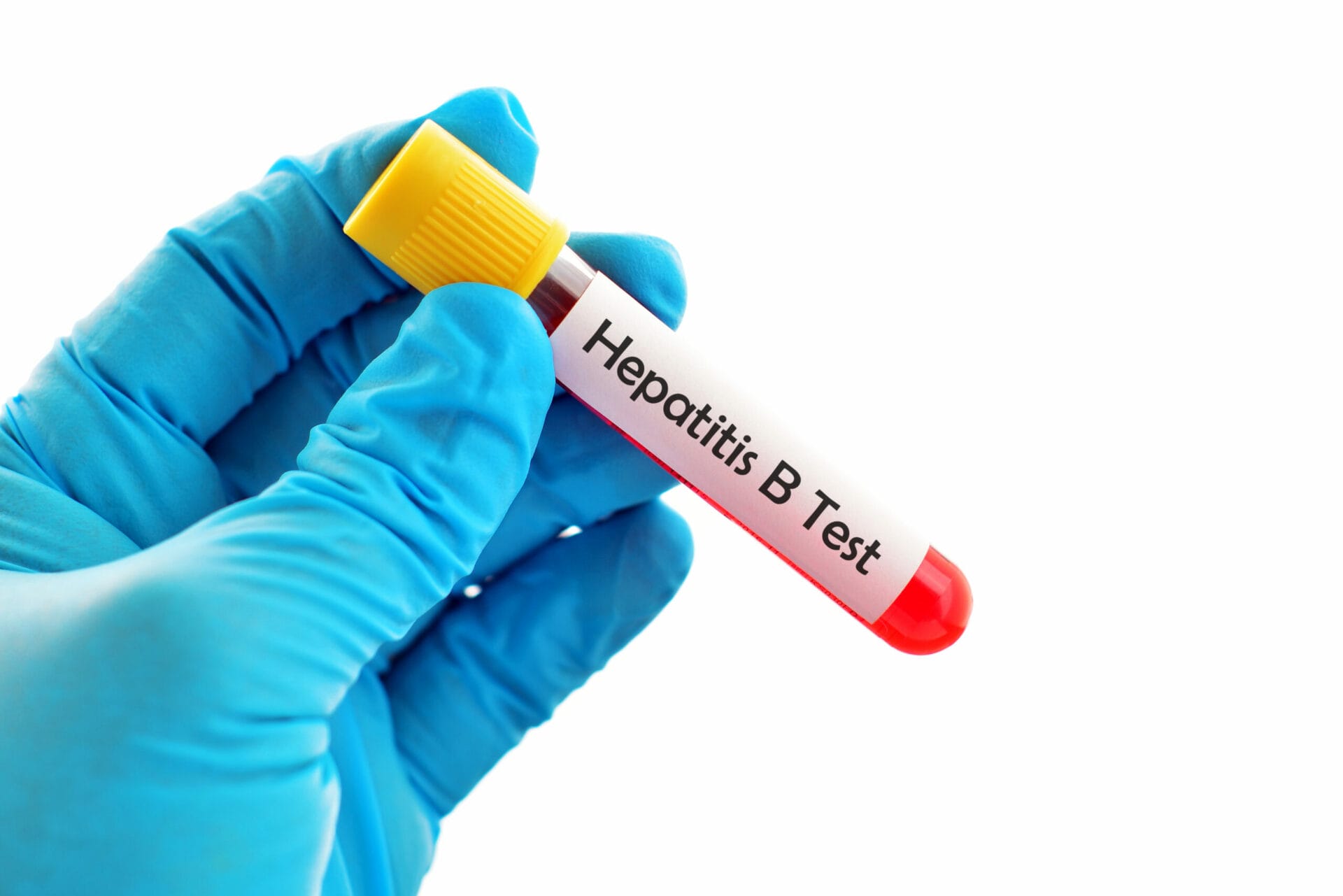 Hepatitis B Test In Jalandhar