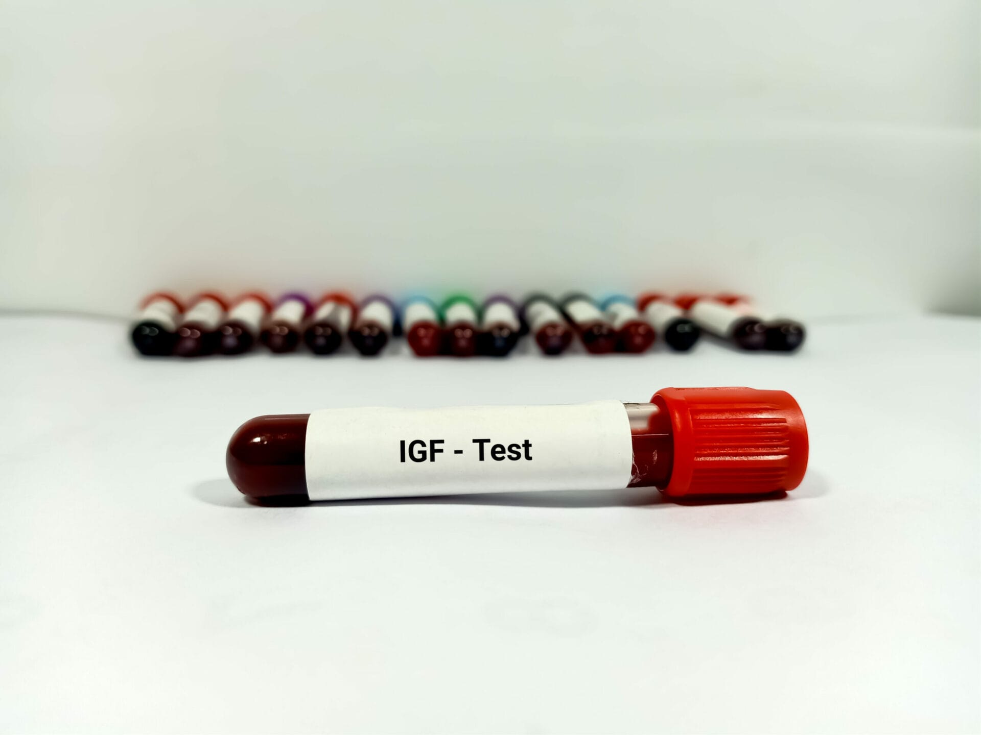 Insulin Like Growth Factor (IGF 1) Test In Bangalore