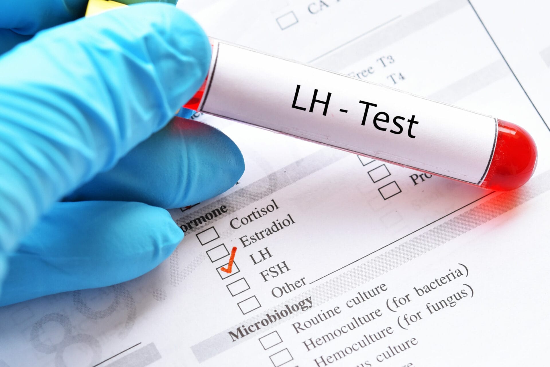 Luteinising Hormone (LH) Test In Ahmedabad