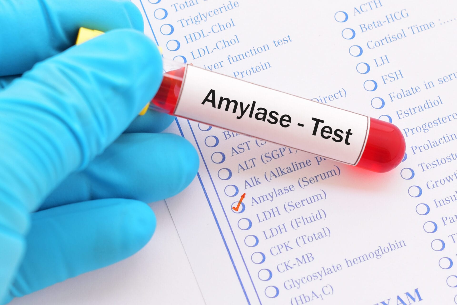 Serum Amylase Test In Ahmedabad