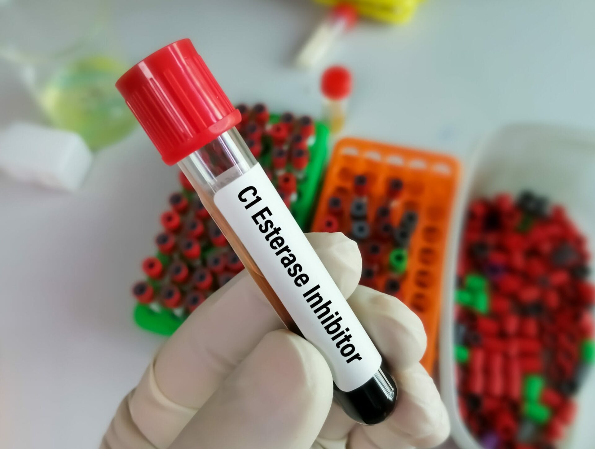 C1 Esterase Inhibitor Quantitative Test in Bangalore