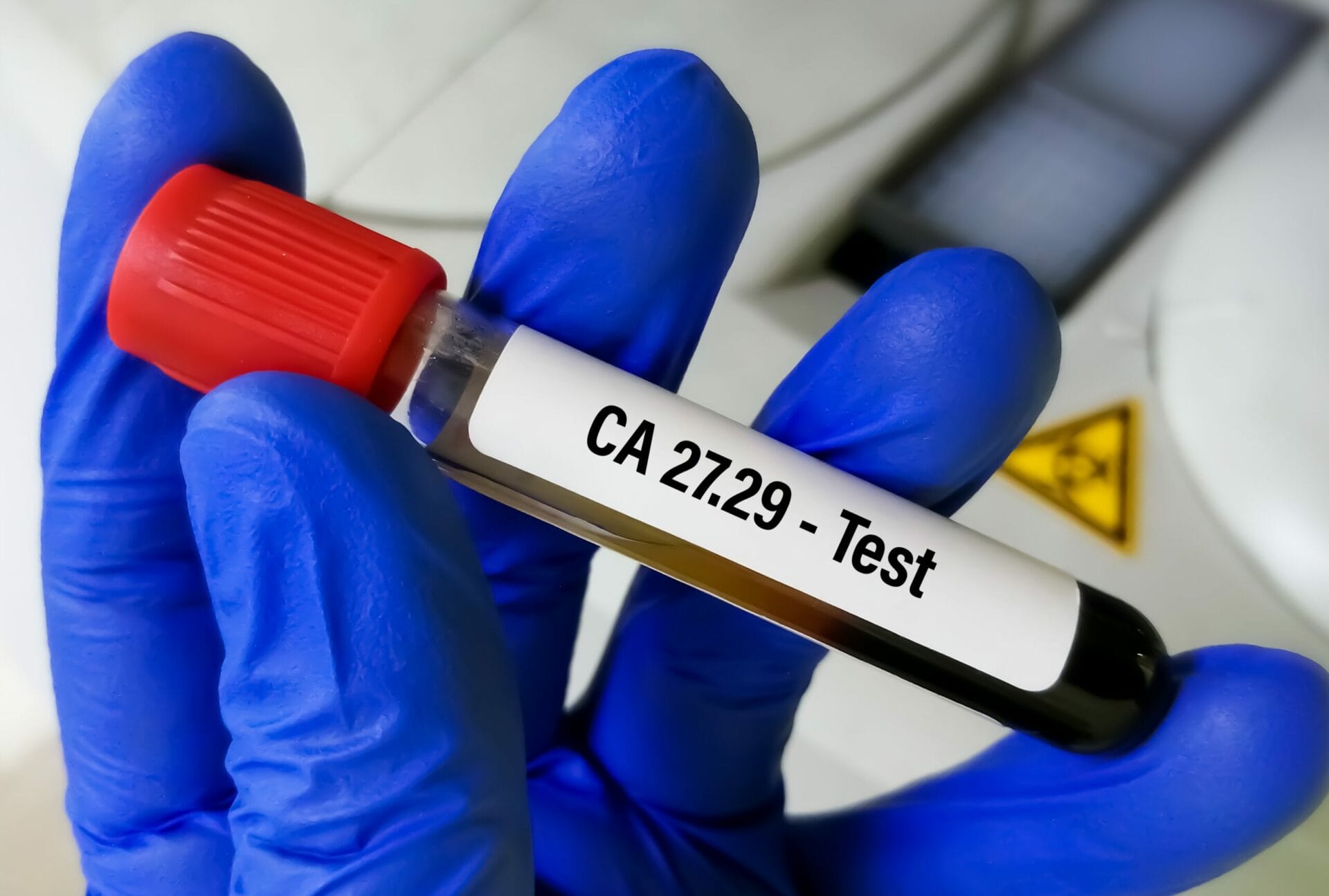 CA 27 29 Test In Noida