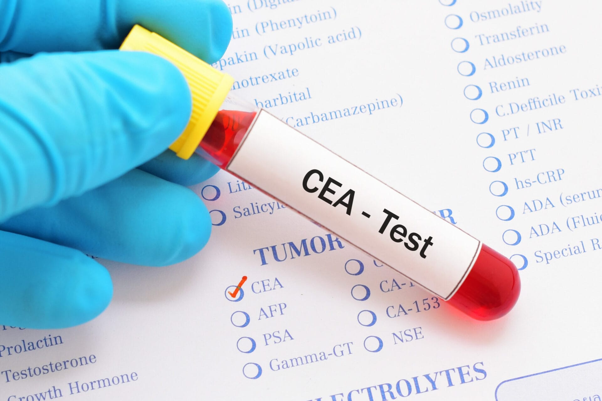 CEA Test in Gurgaon