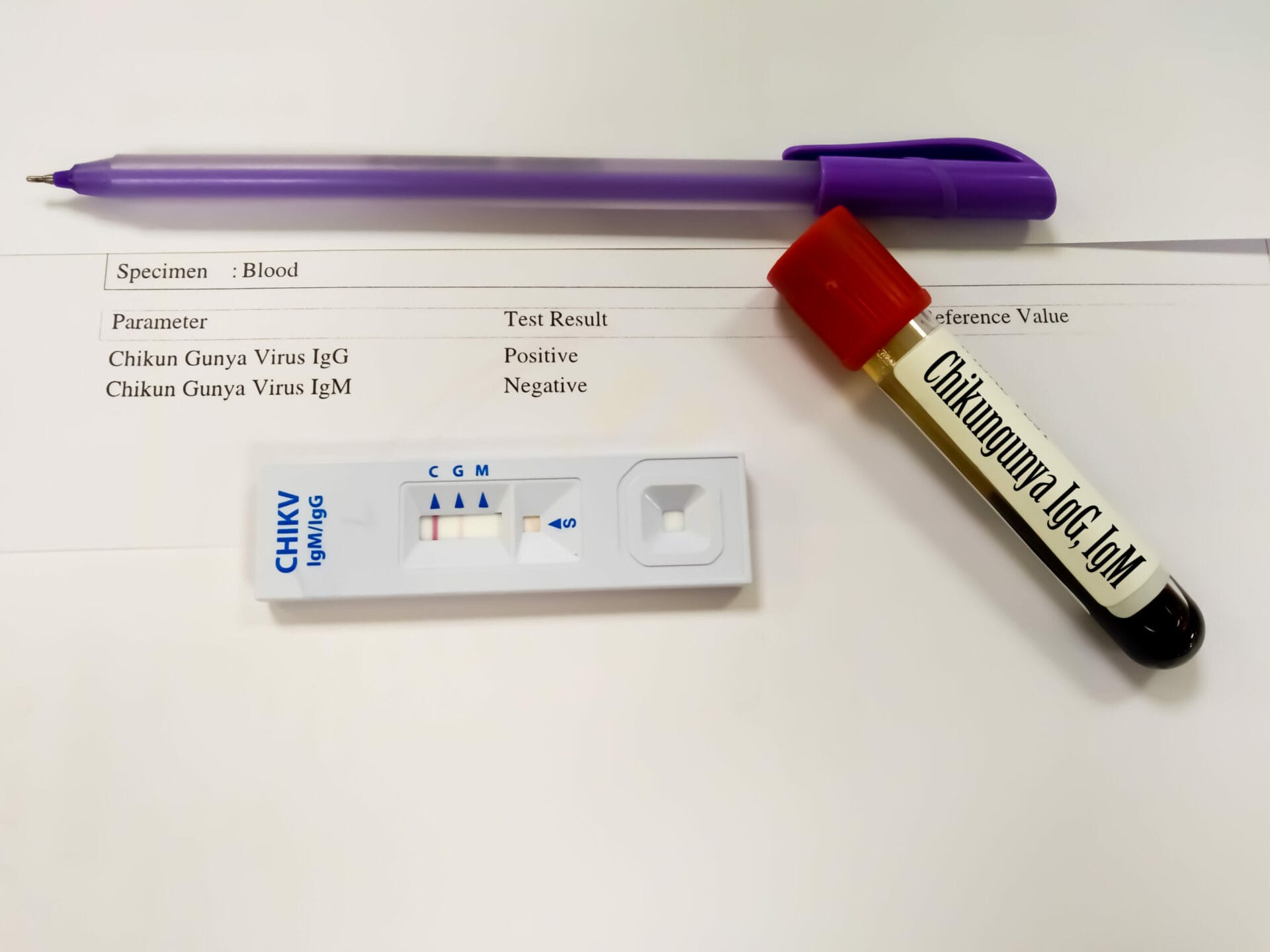 Chikungunya (IgM) Test In Ahmedabad