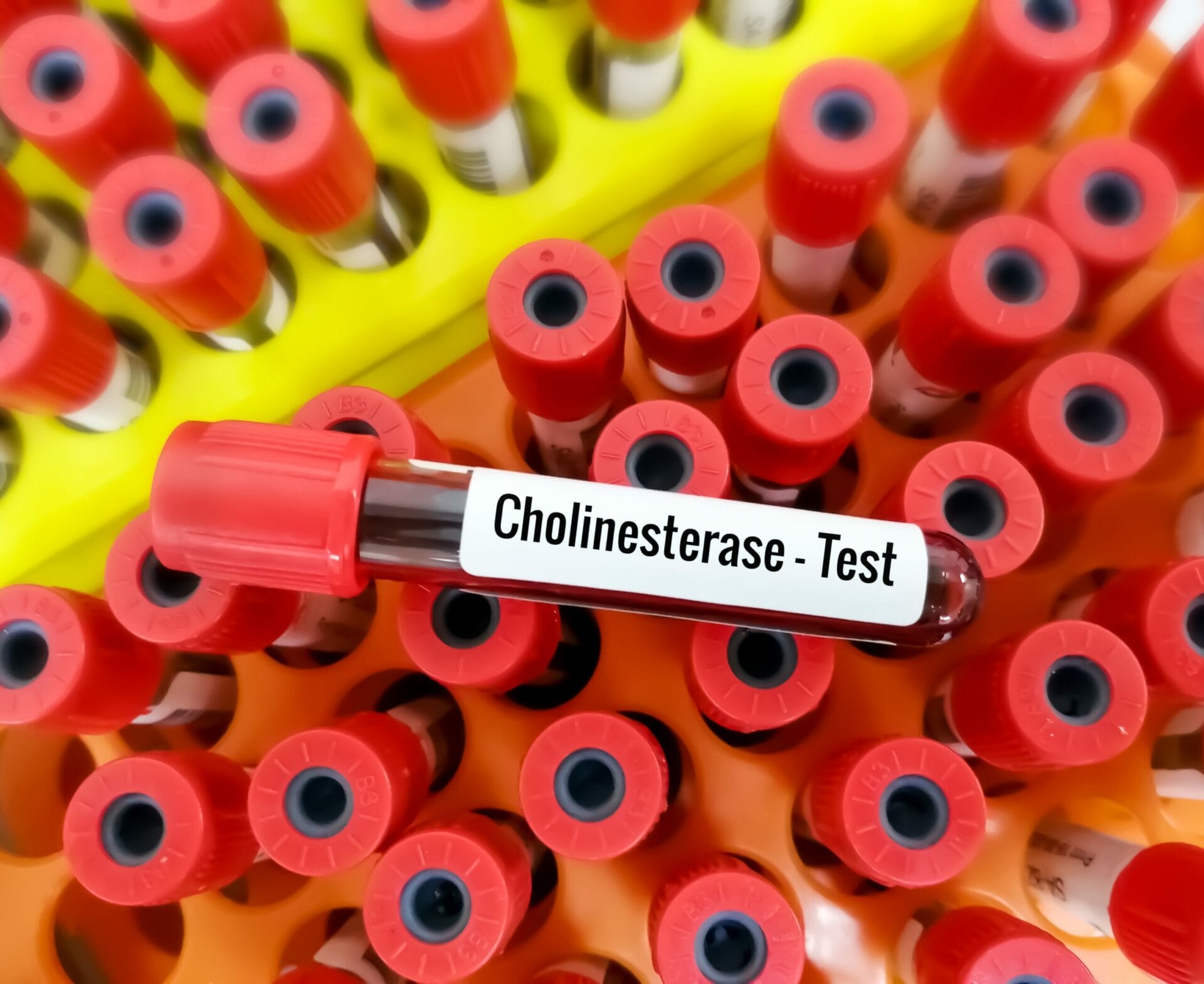 Cholinesterase Test in Mumbai