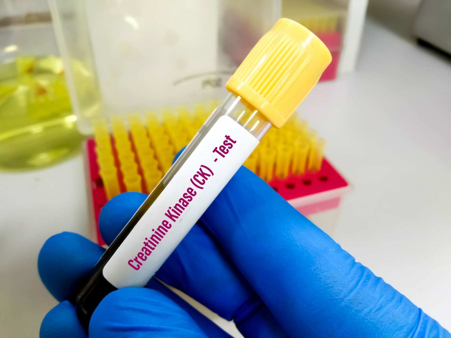 Creatine Kinase Test In Faridabad