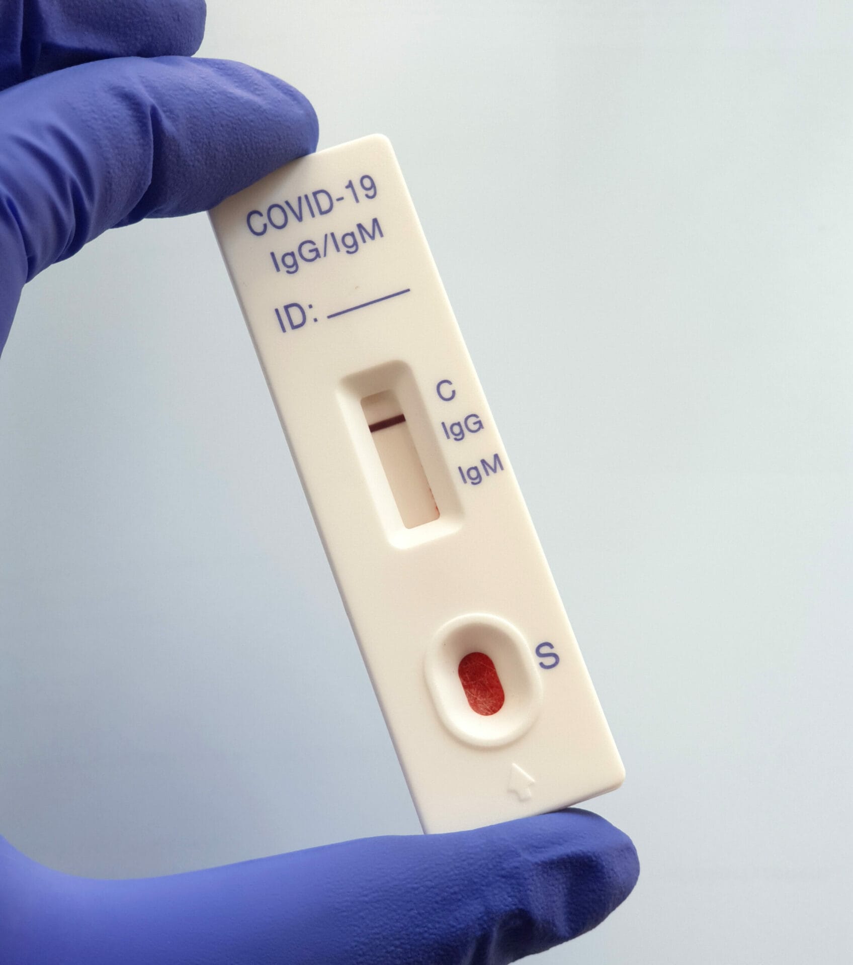 COVID Antibody IGG Test In Chandigarh