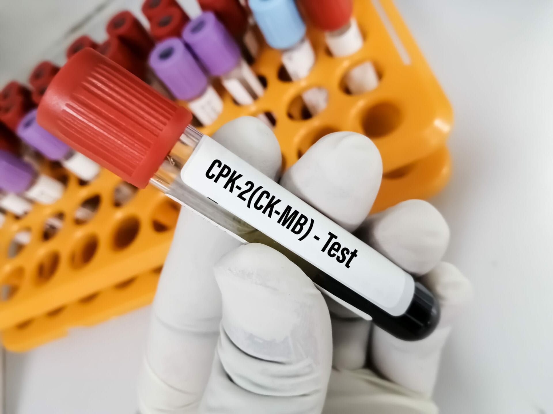 Creatine Kinase MB (CK-MB) Test In Faridabad