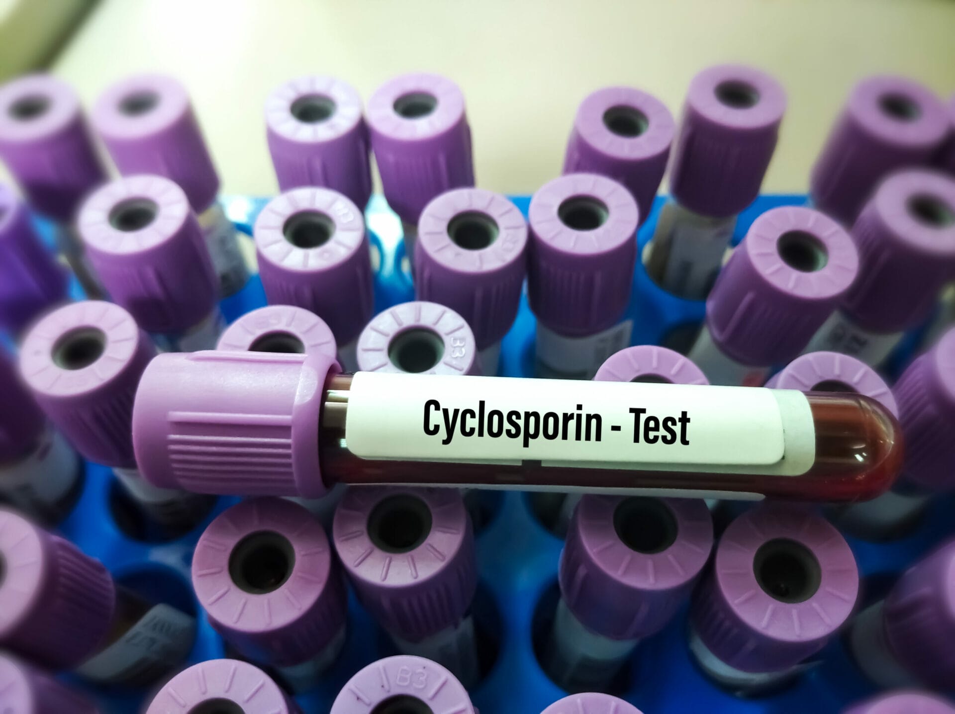 Cyclosporine Test In Gurgaon