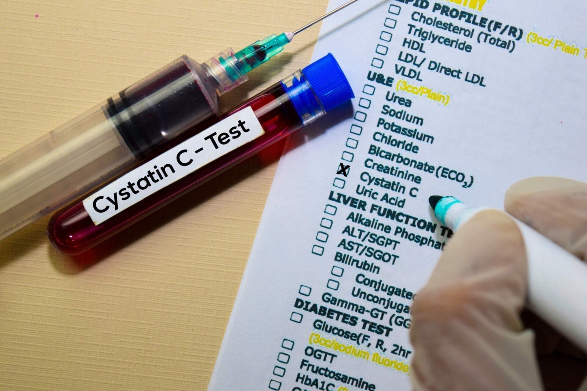 Cystatin C Test In Delhi