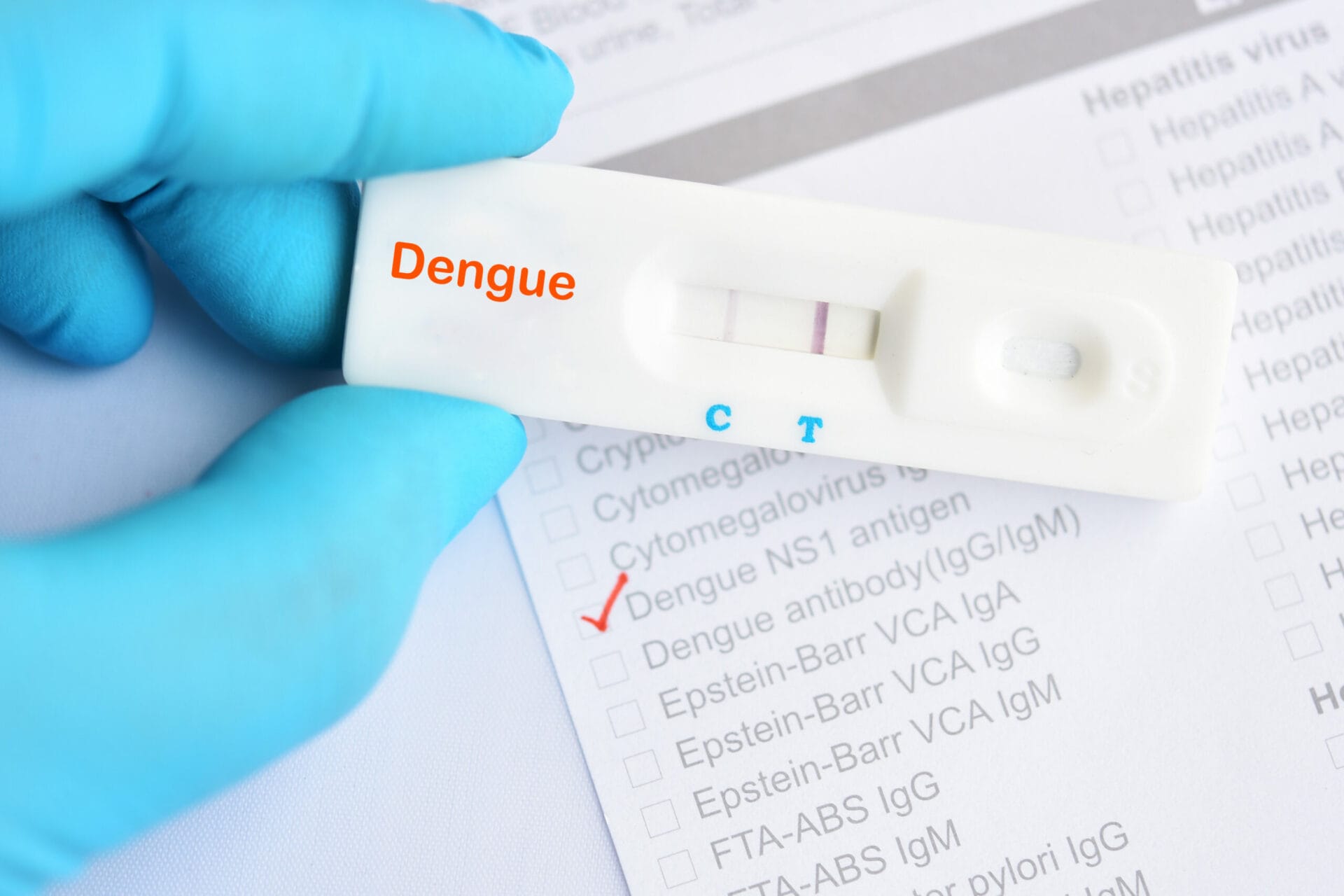 Dengue Fever IgG Antibody Test In Chandigarh