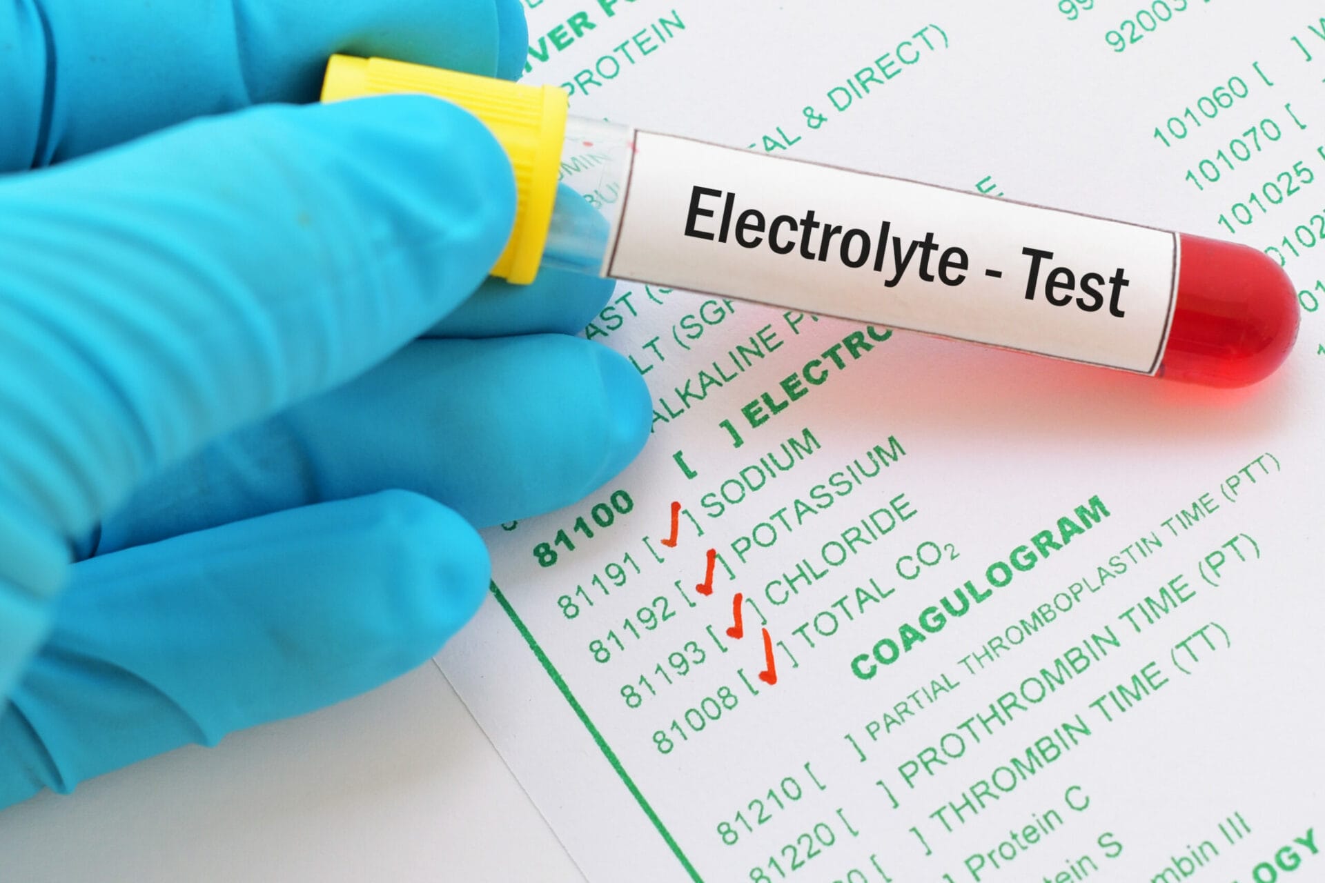 Serum Electrolytes Test In Lucknow