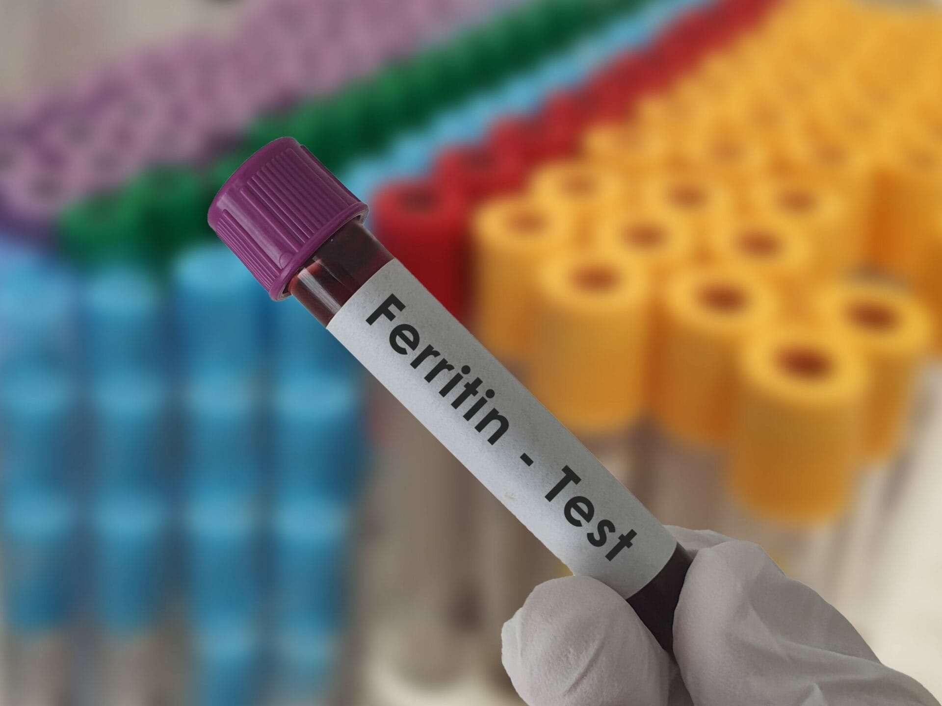 Ferritin Test In Ahmedabad