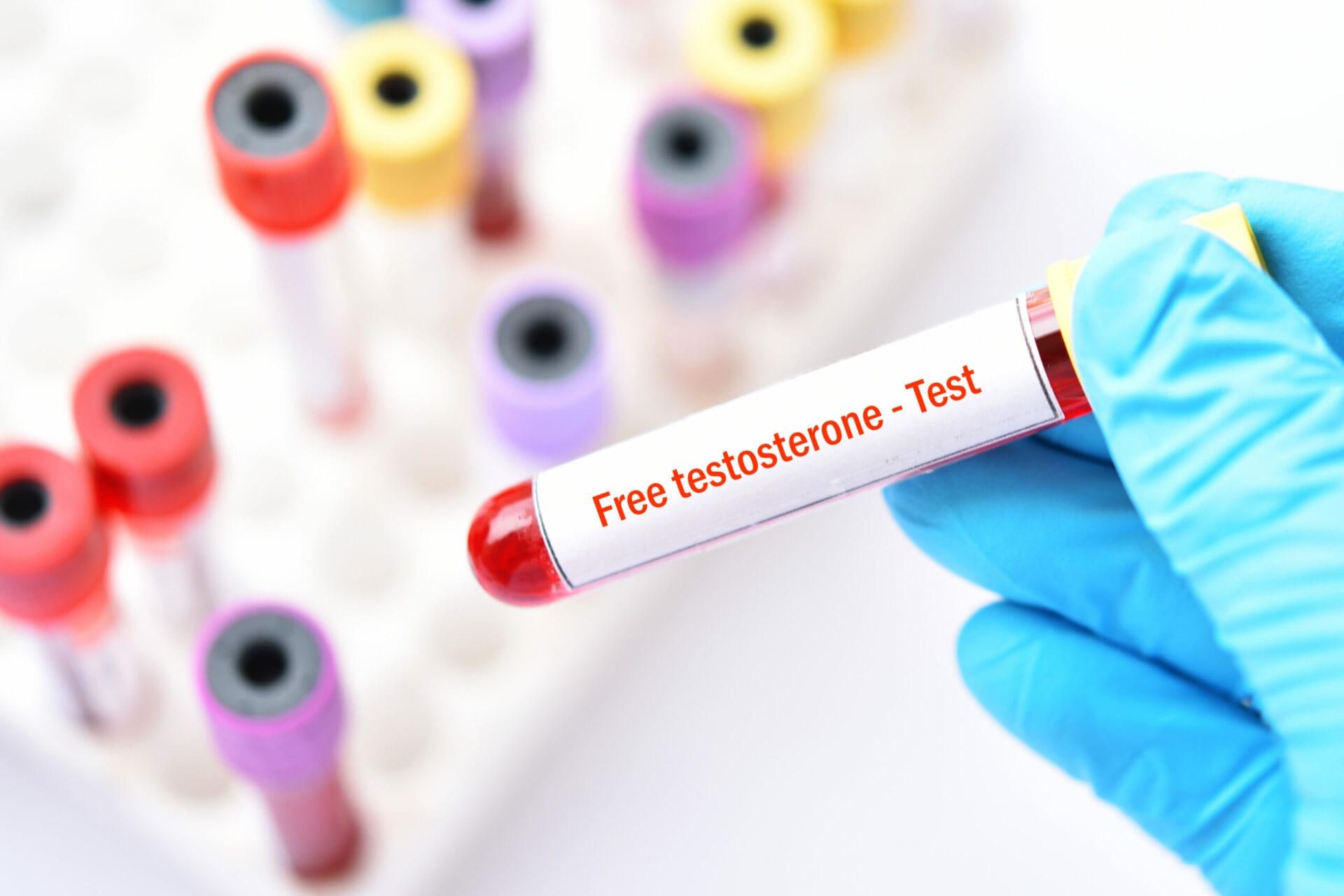 Free Testosterone Test in Lucknow