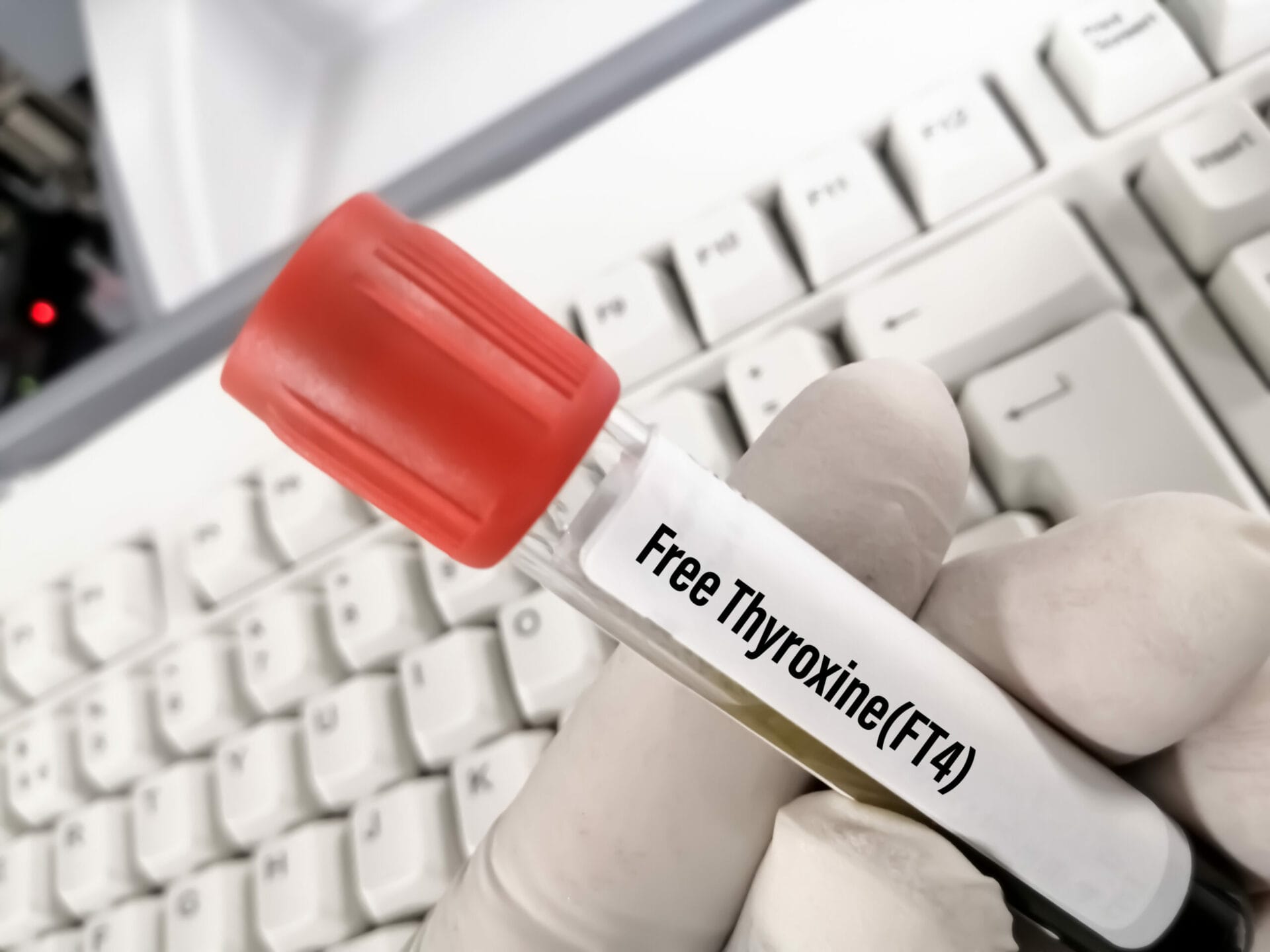 Free Thyroxine Test In Jalandhar