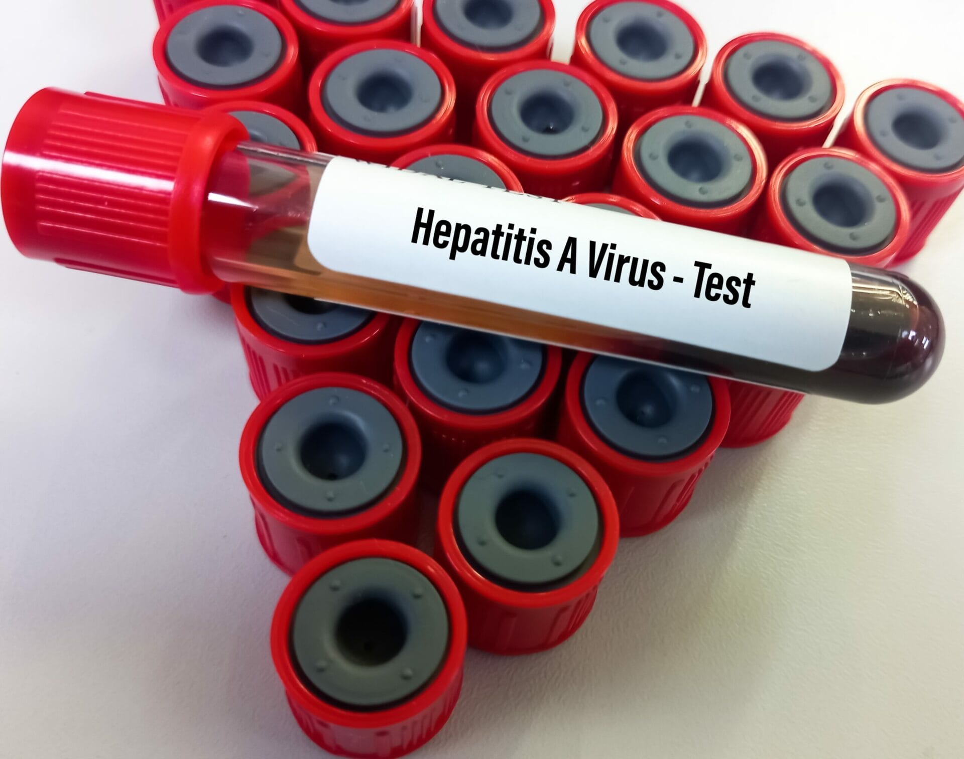 Hepatitis A Test in Noida