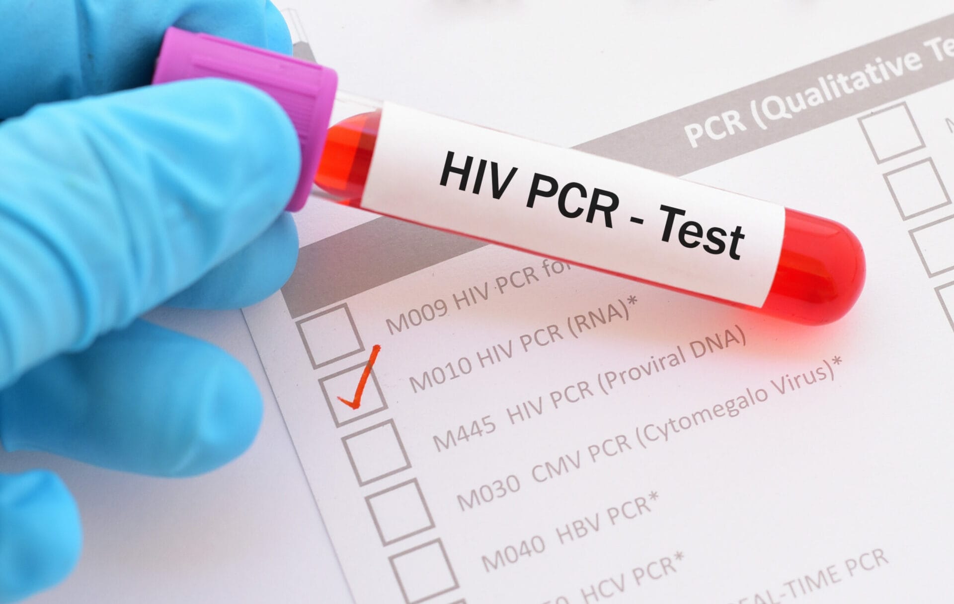 HIV RNA PCR test in Lucknow