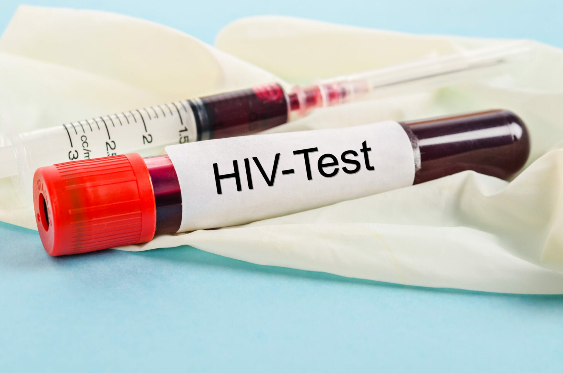 HIV Test In Lucknow