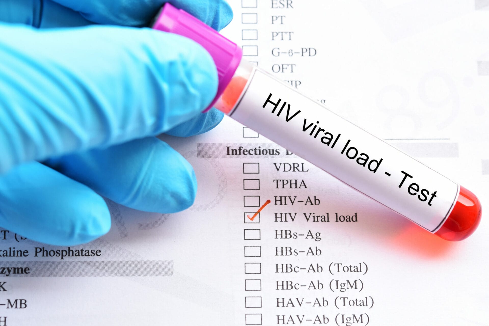 HIV Viral Load Test in Ahmedabad