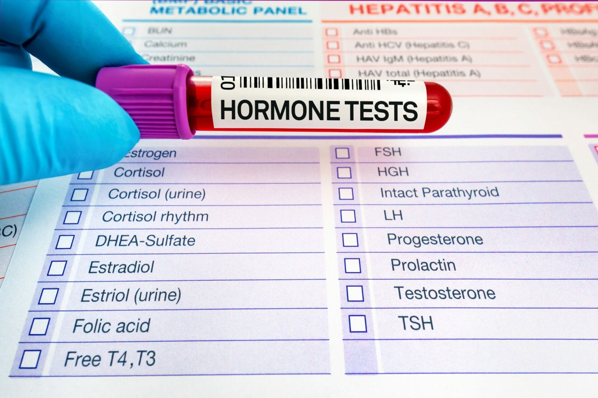 Hormone Tests In Delhi