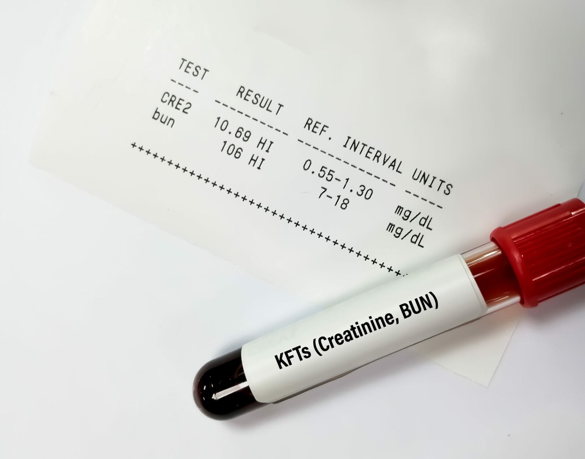 Kidney Function (KFT) Test in Chandigarh
