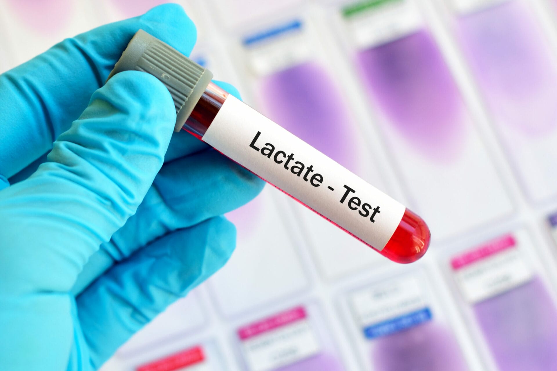 Lactate Test In Jalandhar