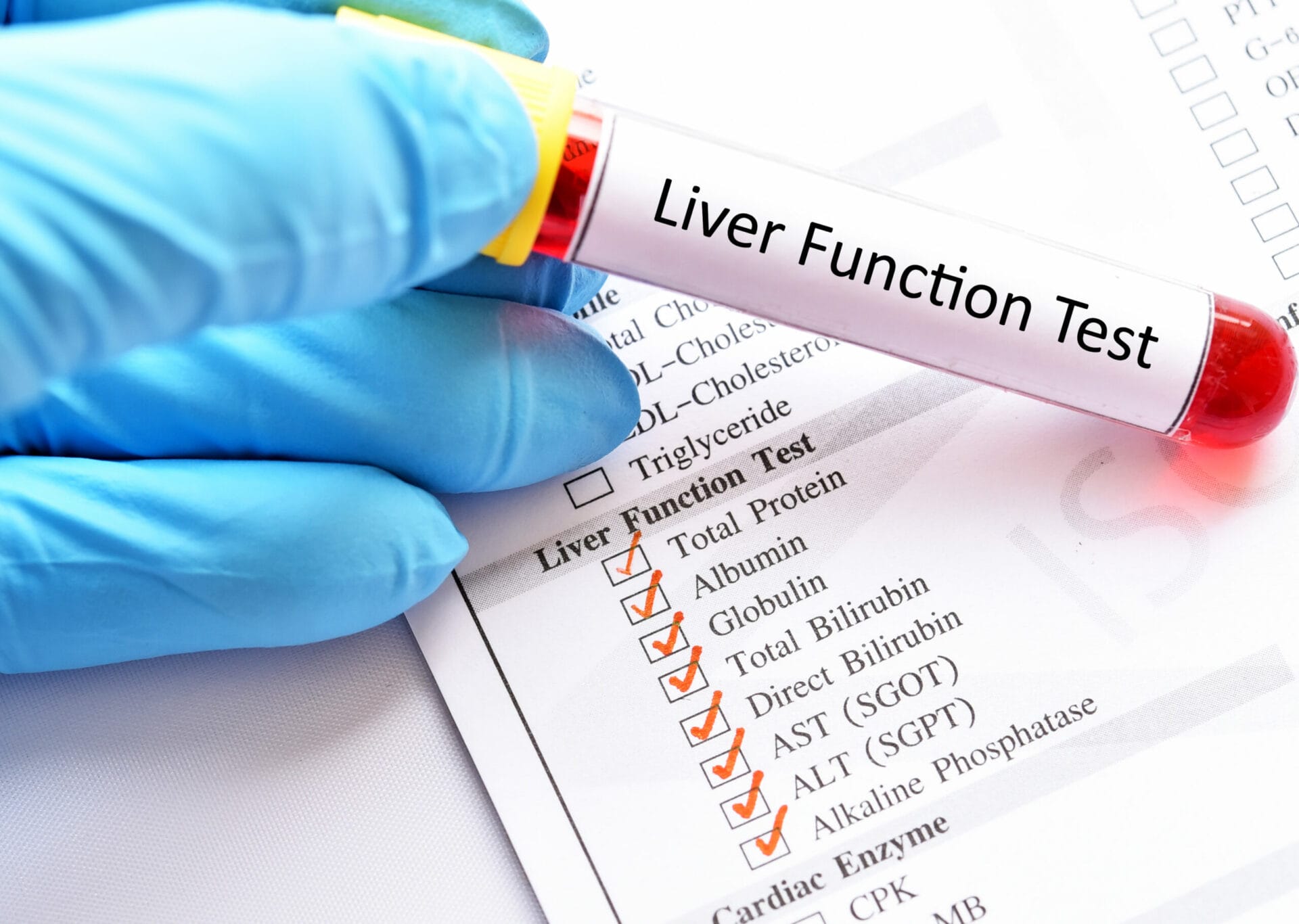 Liver Function (LFT) Test in Pune