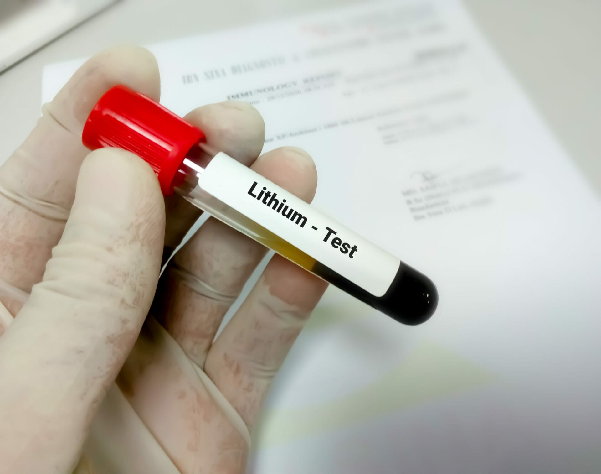 Lithium (Li) Test In Noida