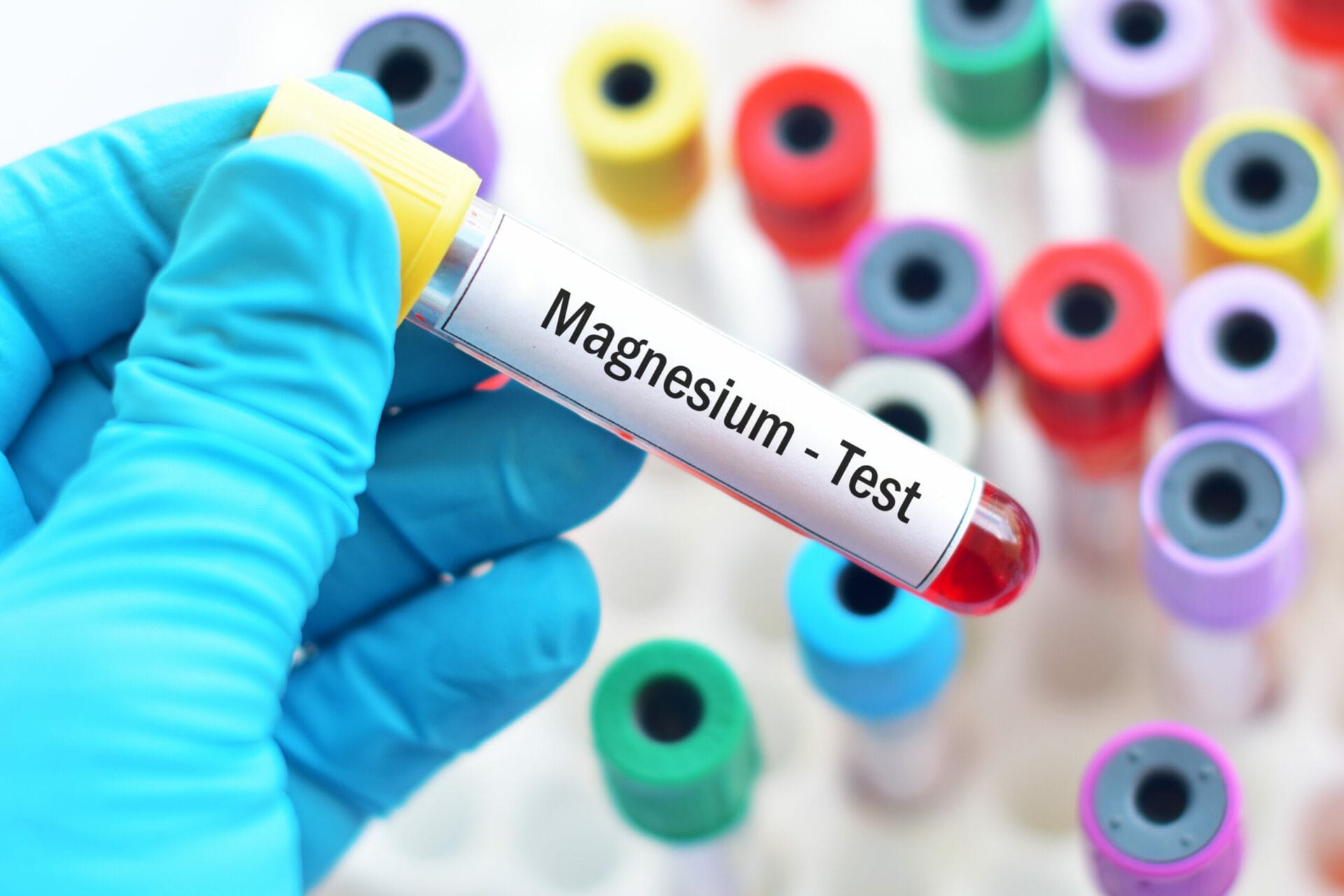 Magnesium Test In Lucknow