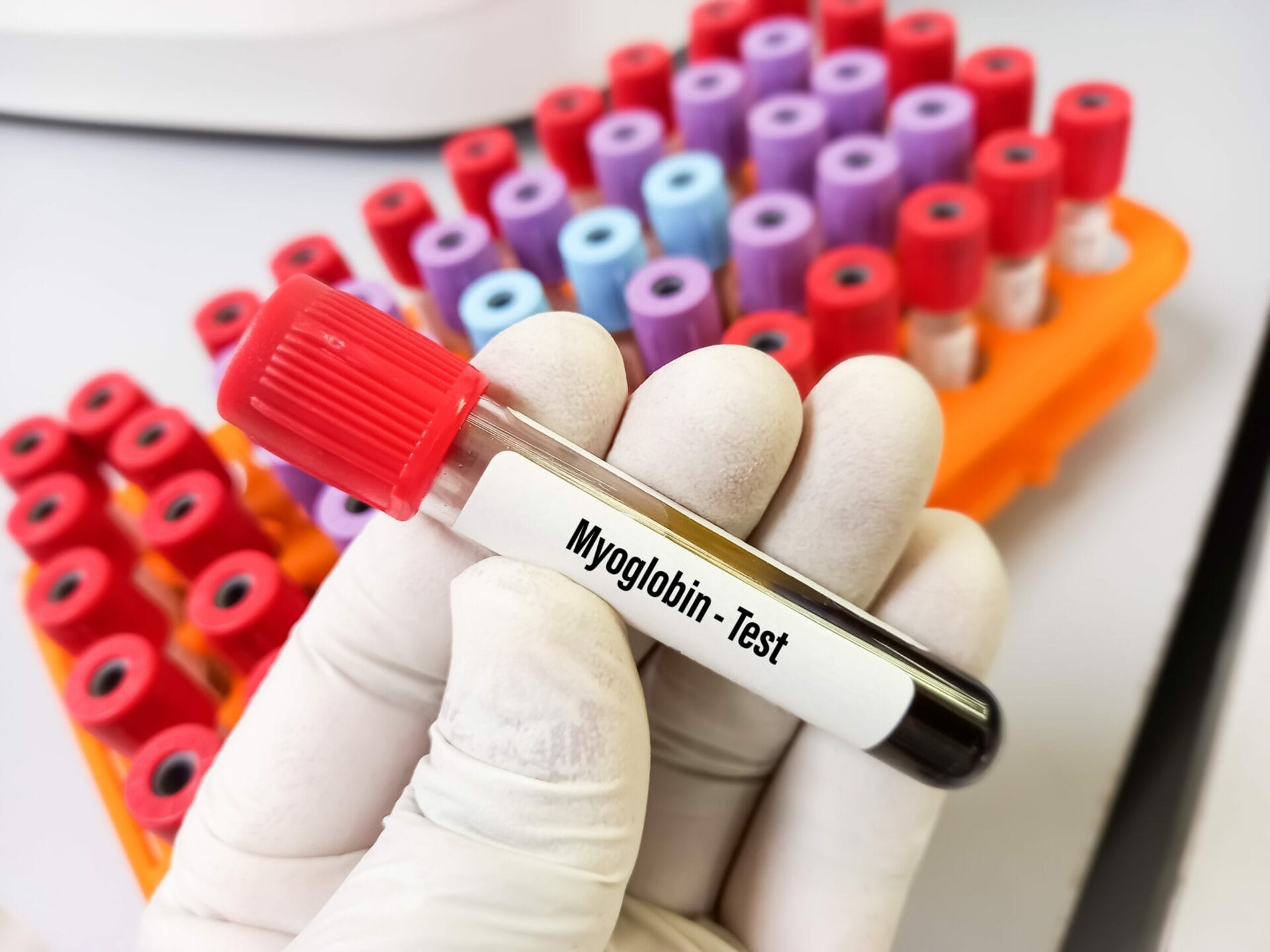 Myoglobin Test In Lucknow