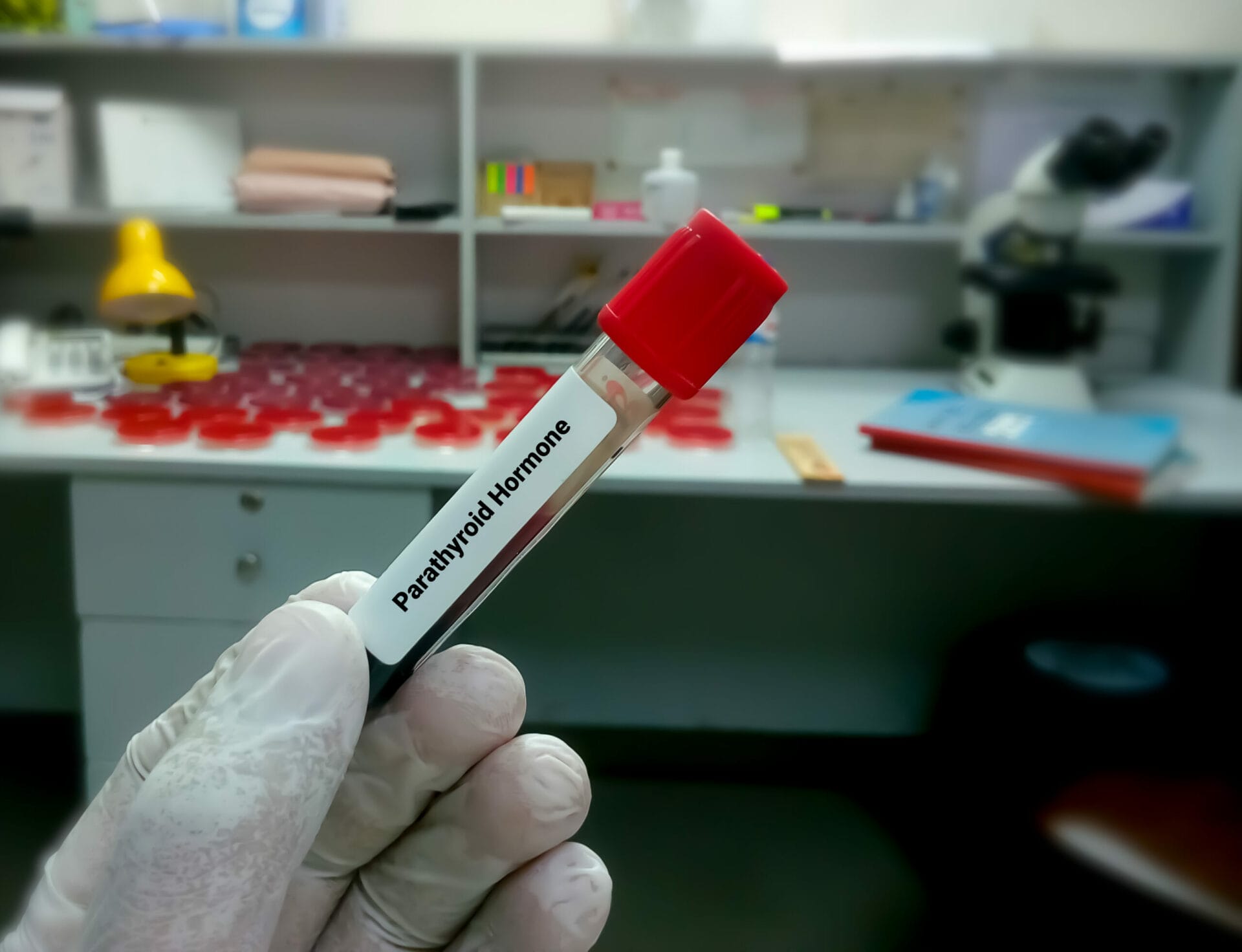 Intact Parathyroid Hormone Test in Kolkata