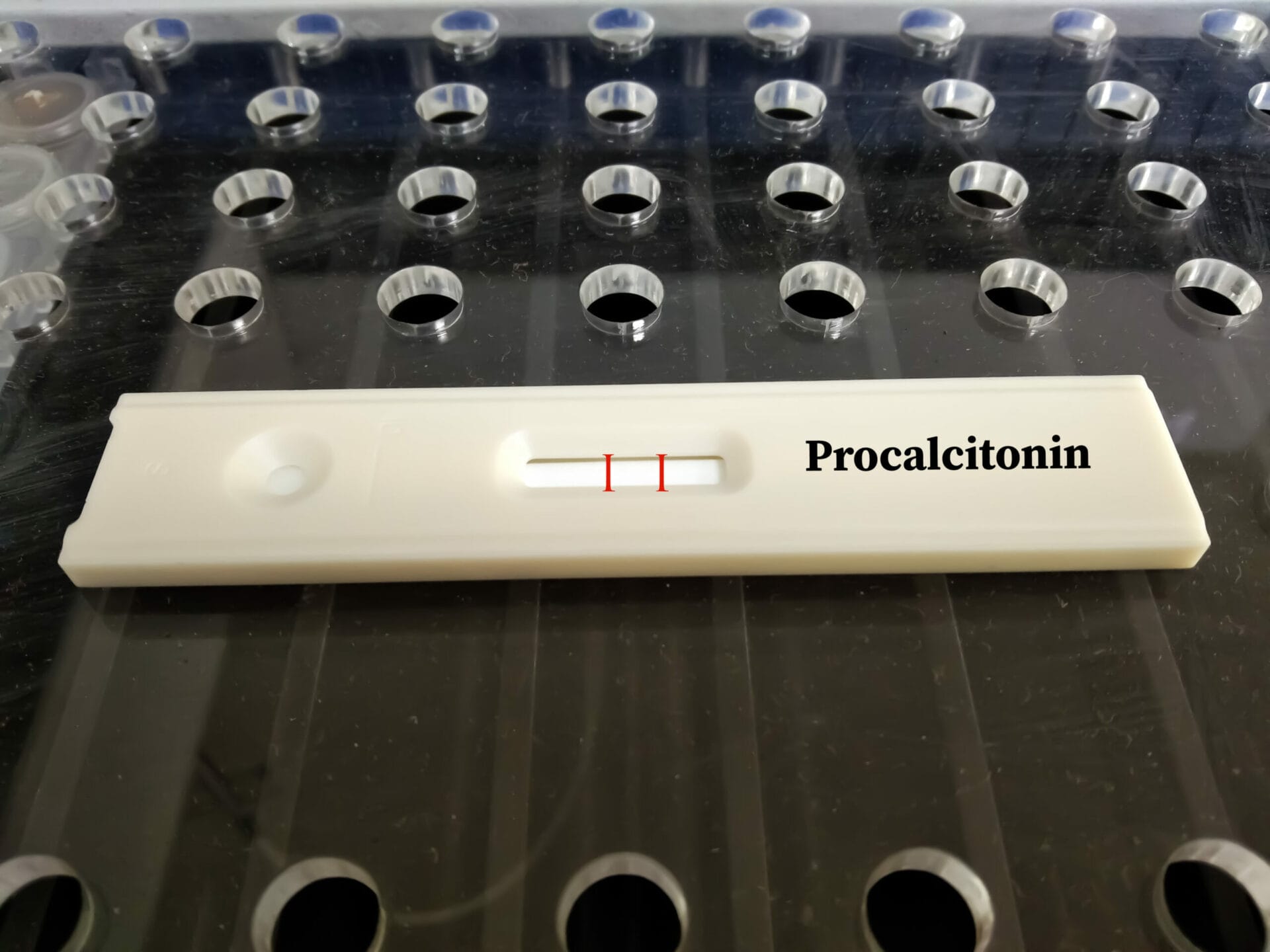 Procalcitonin Test In Kolkata