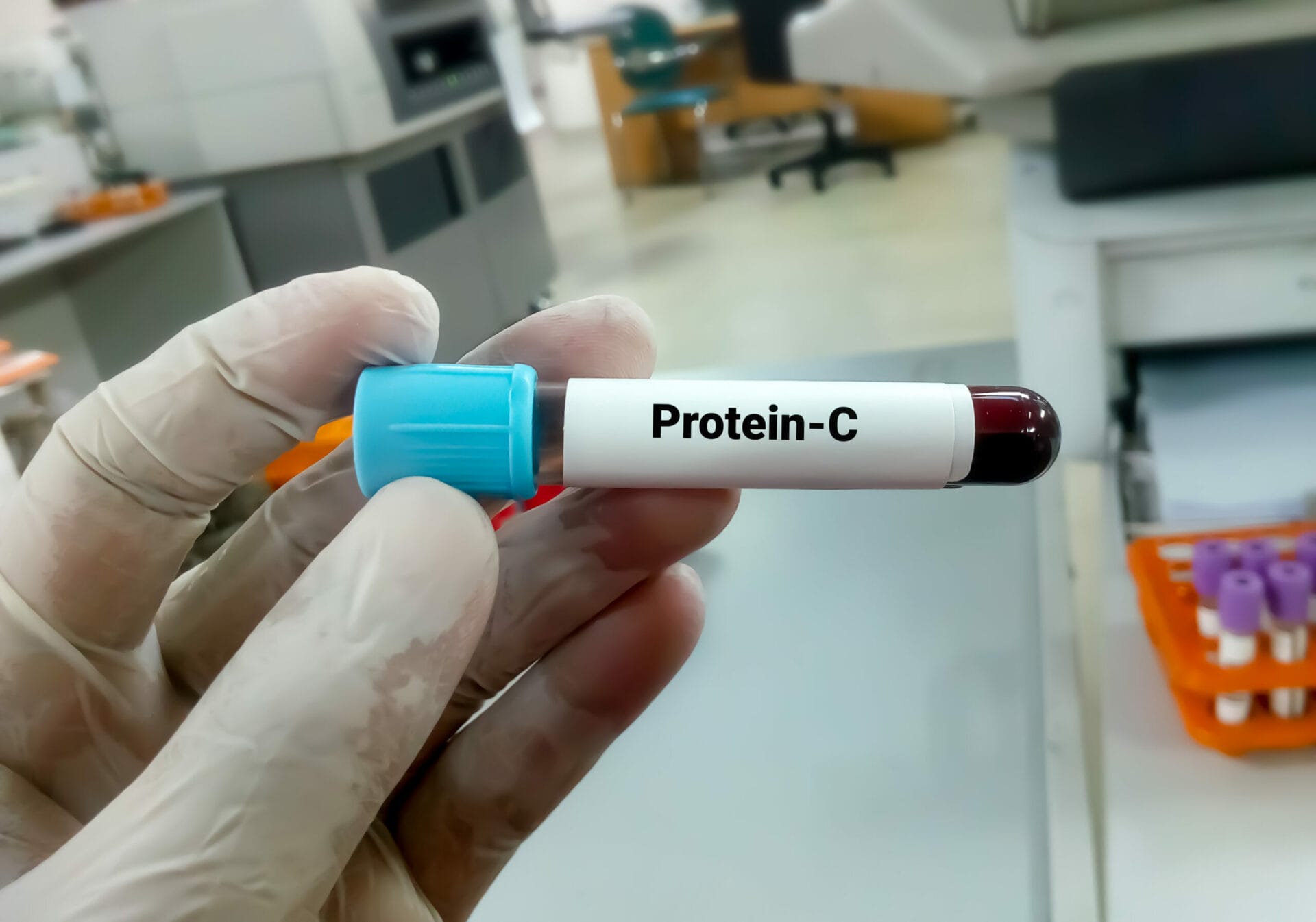 Protein C Antigen Test in Noida