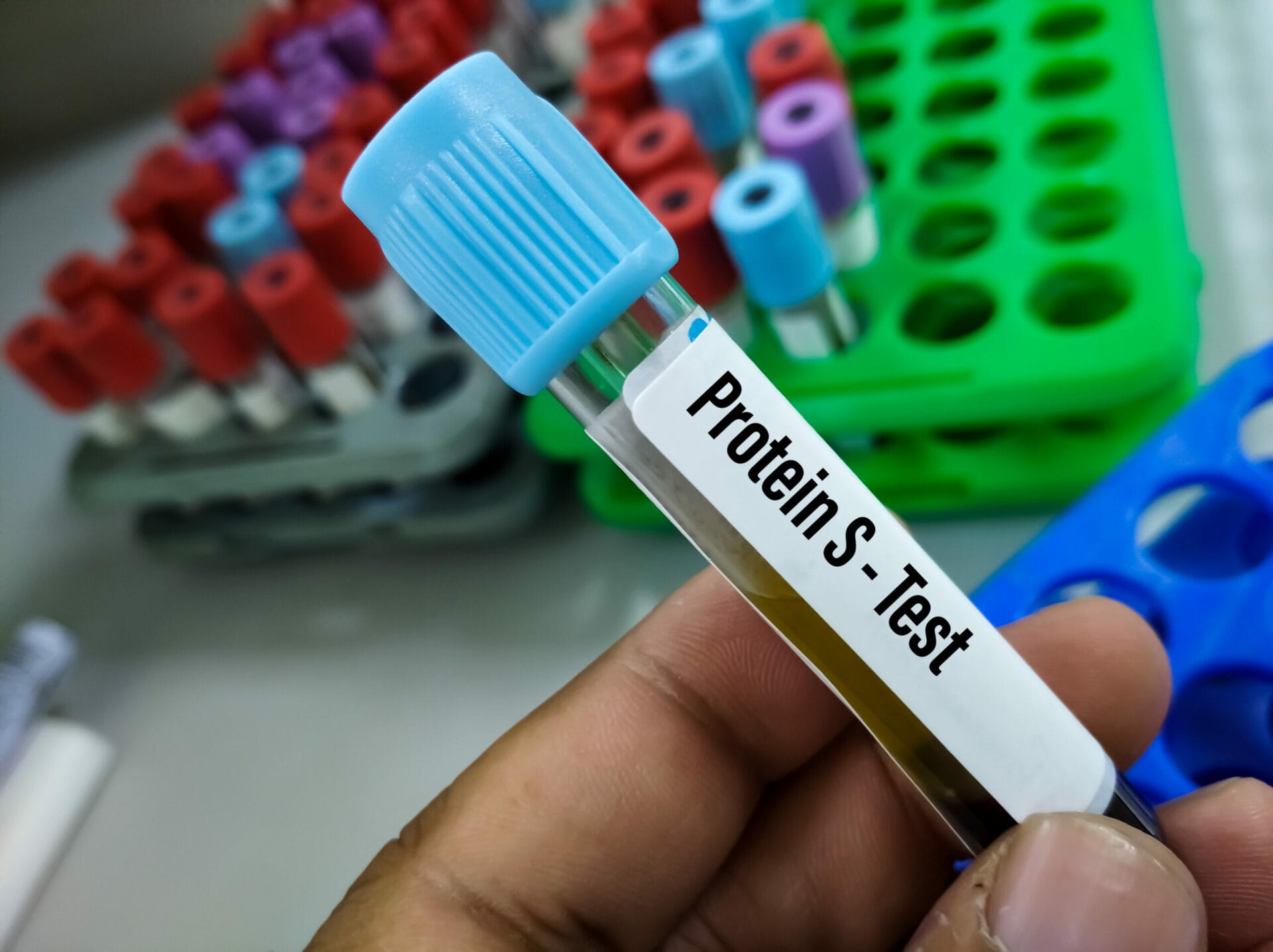 Protein S Test In Delhi