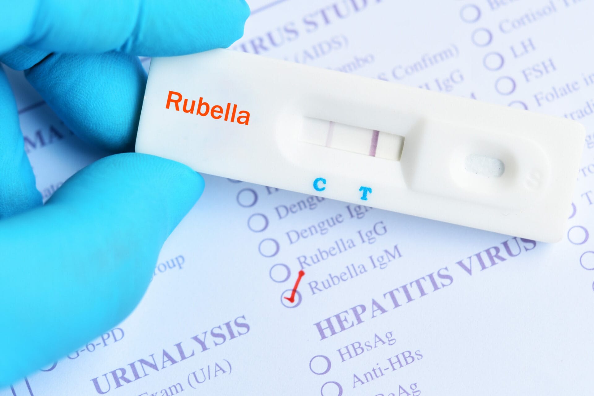 Rubella Virus IGG Test In Pune