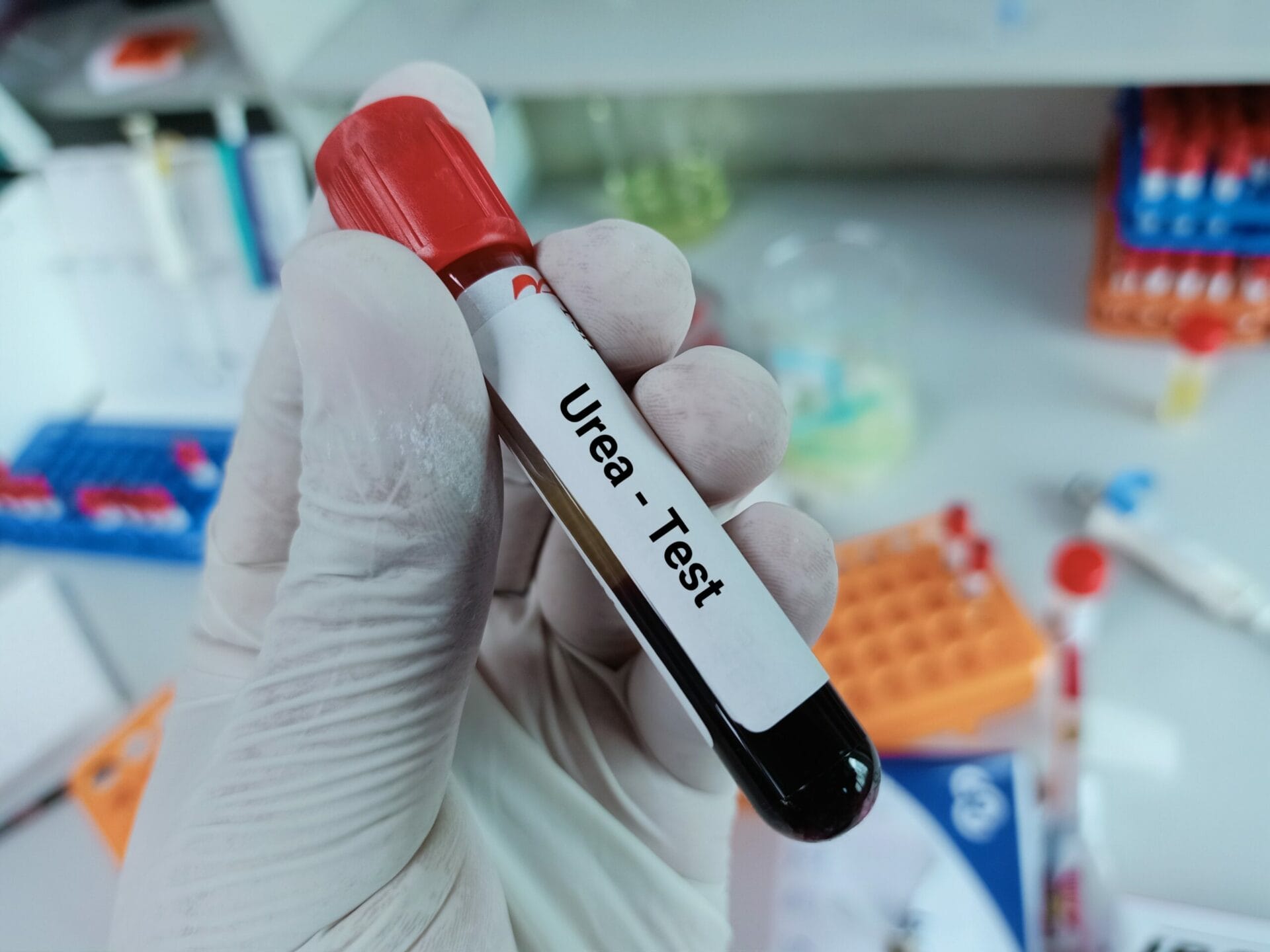 Serum Urea Test In Delhi