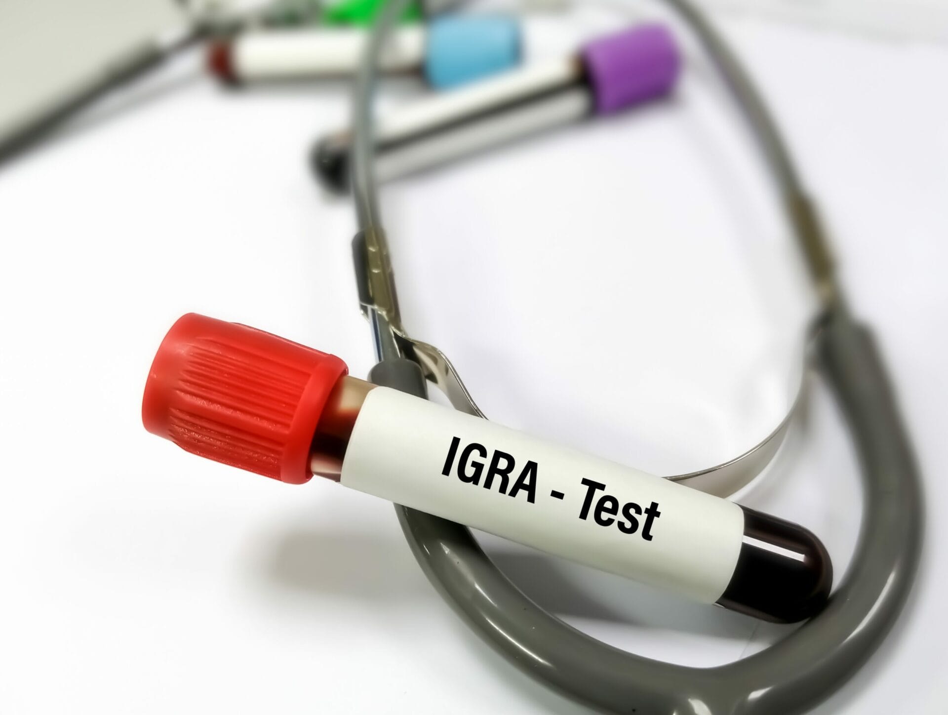 TB IGRA Test In Bangalore