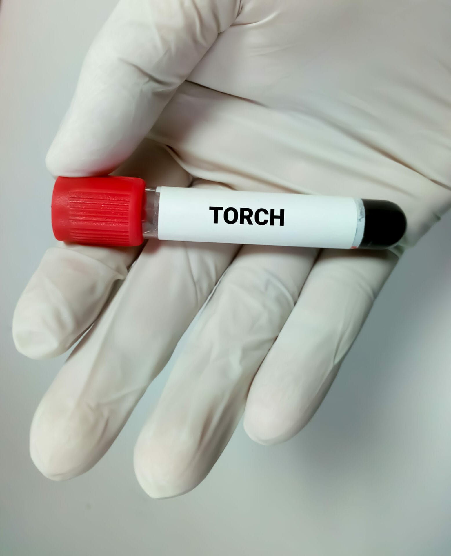 Torch 4 Profile (IgM) Test in Chandigarh